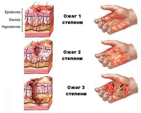  Классификация