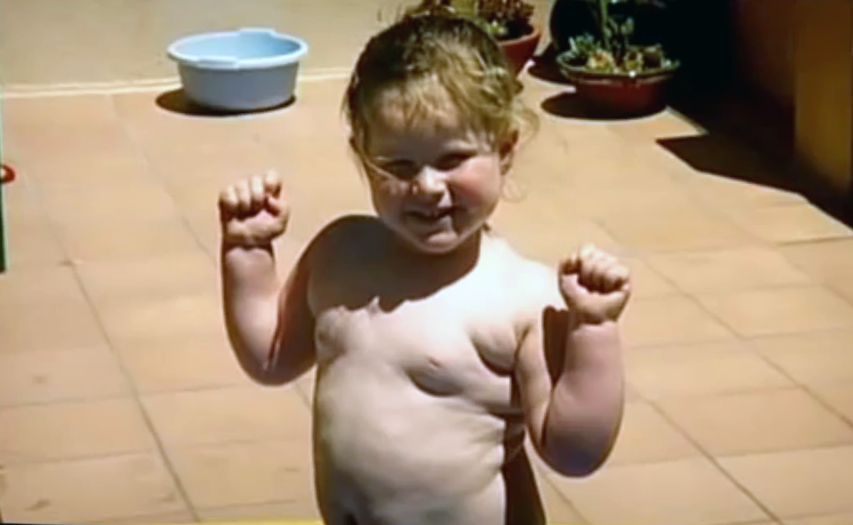  (ИМТ) был выше в возрасте 3 лет.