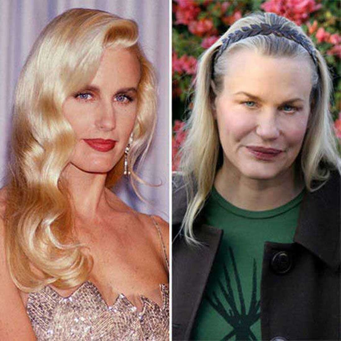 Дэрил Ханна до и после операций