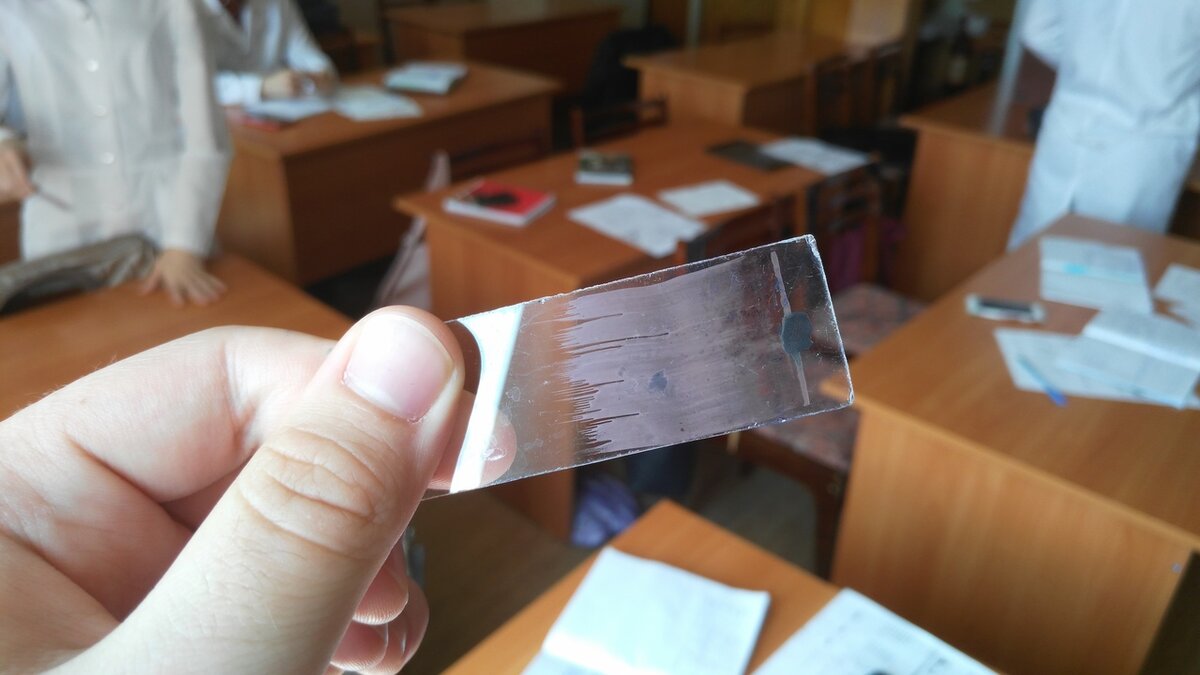 Мазок крови для микроскопического исследования
