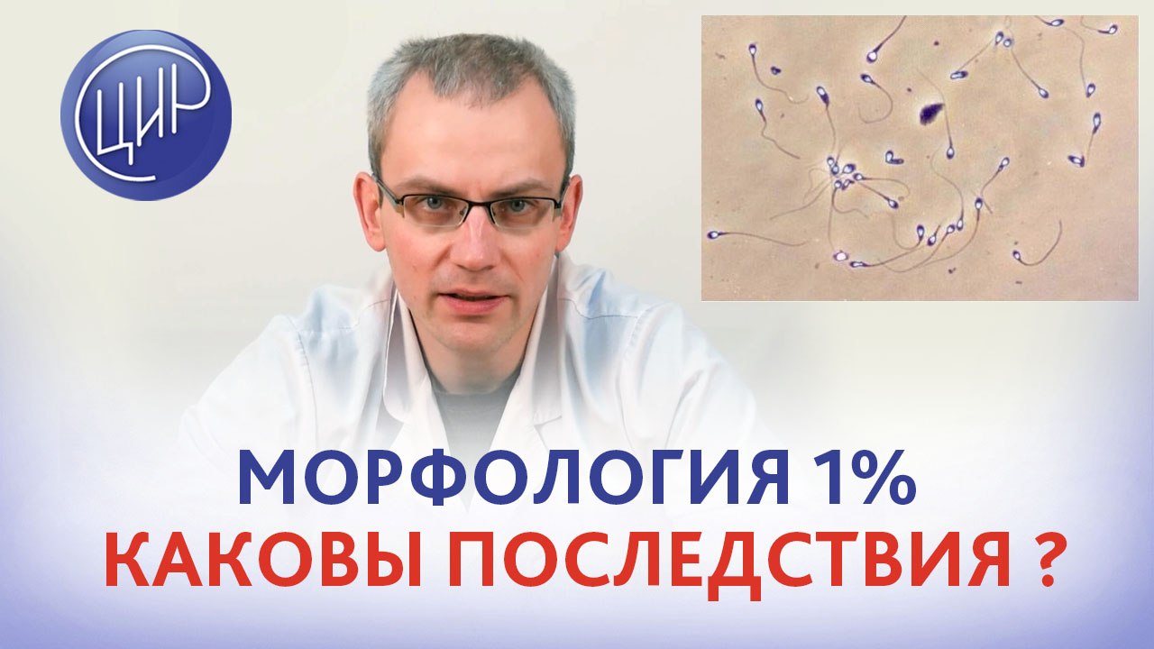 Тератозооспермия - причины, лечение, цена | Клиника «Линия жизни» в Москве