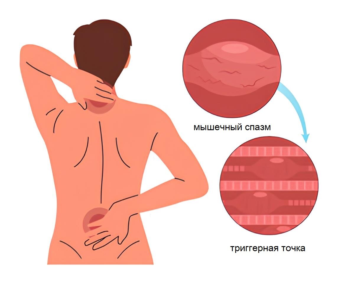 Коррекция нарушений осанки