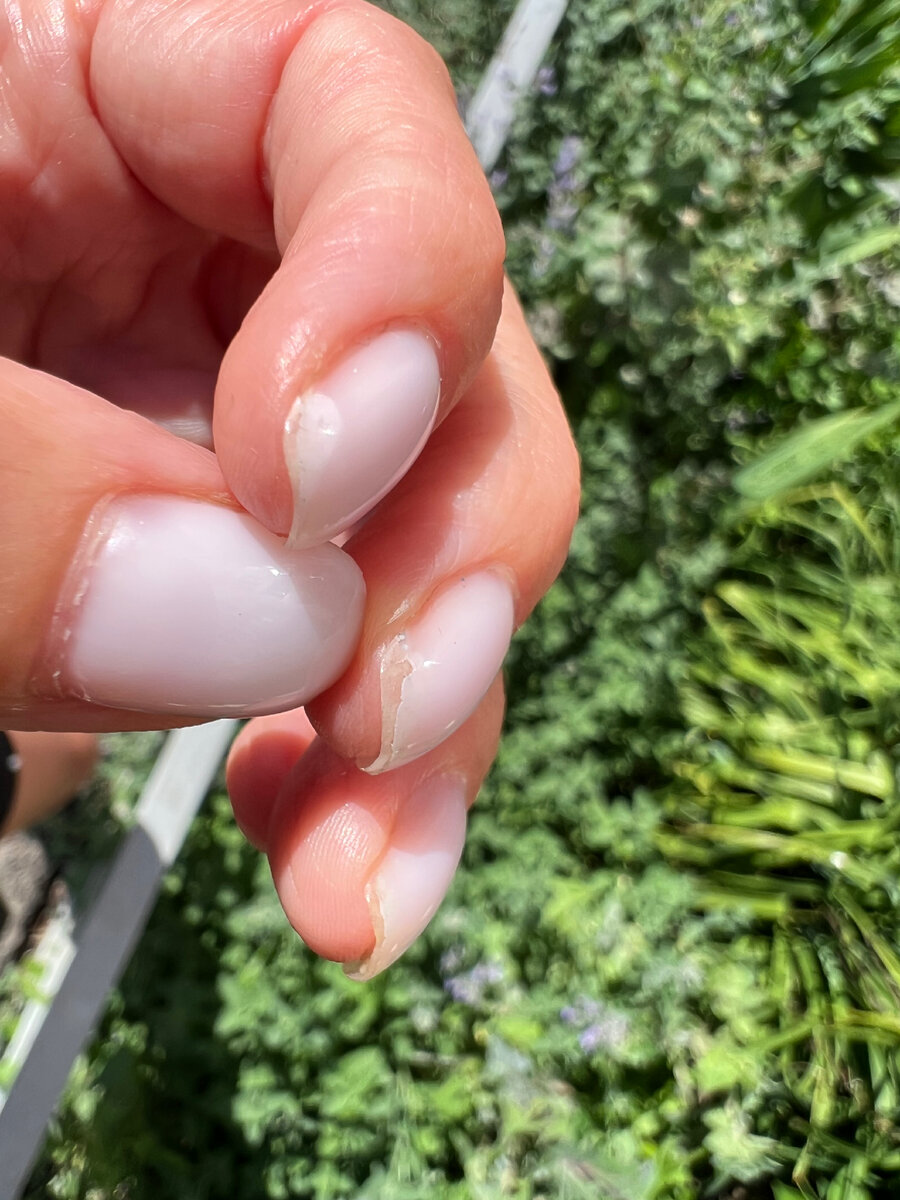 Вот такая «красота» за 5 дней носки