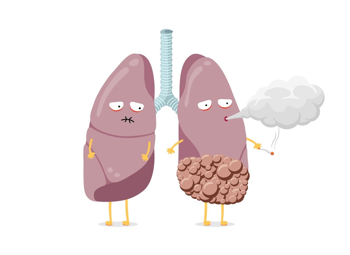 Как очистить легкие после курения: топ-6 методов. Рассказывает нарколог |  Клиника доктора Шурова | Дзен