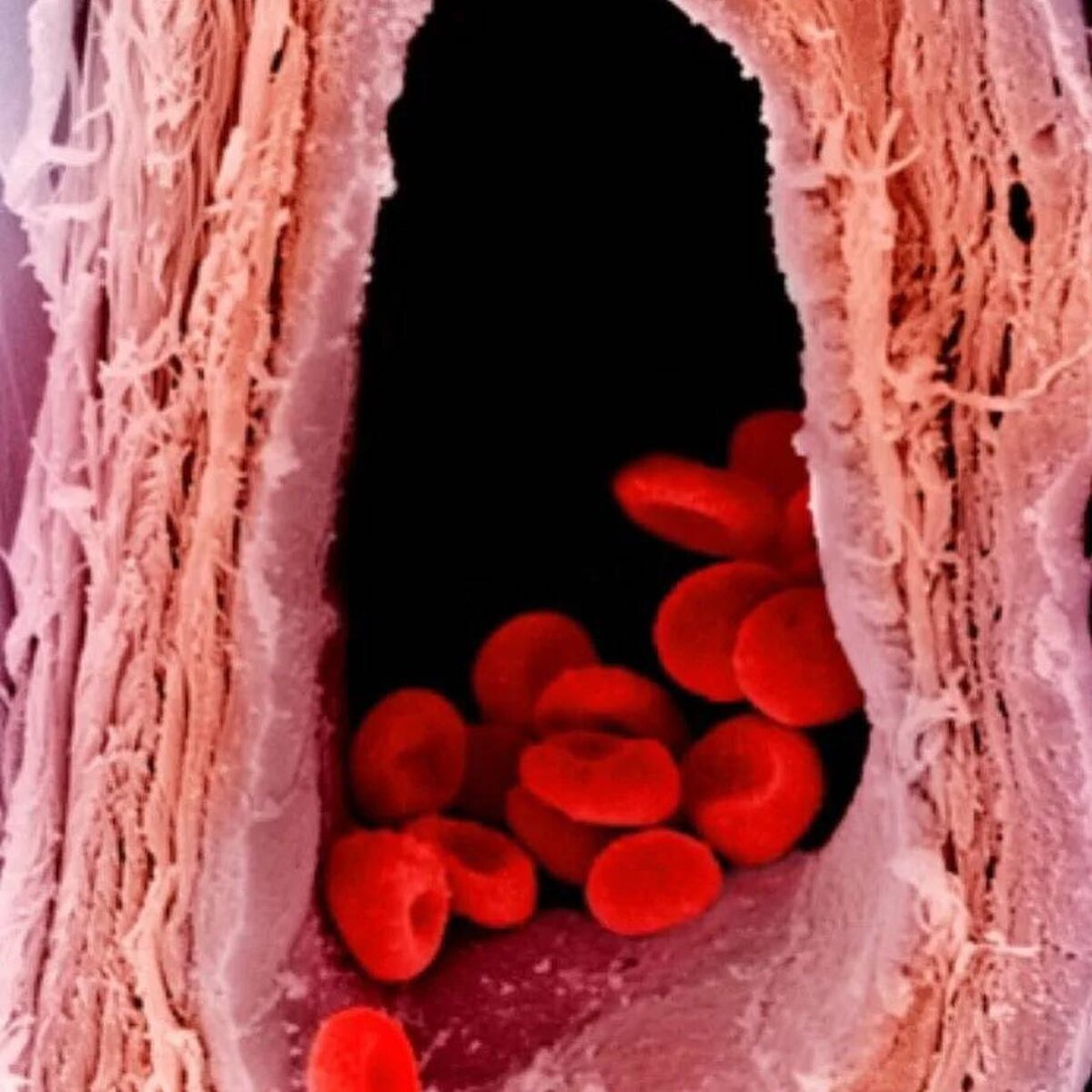 Часть 1. Чем отличается артериальная кровь и венозная? | Медицина ...