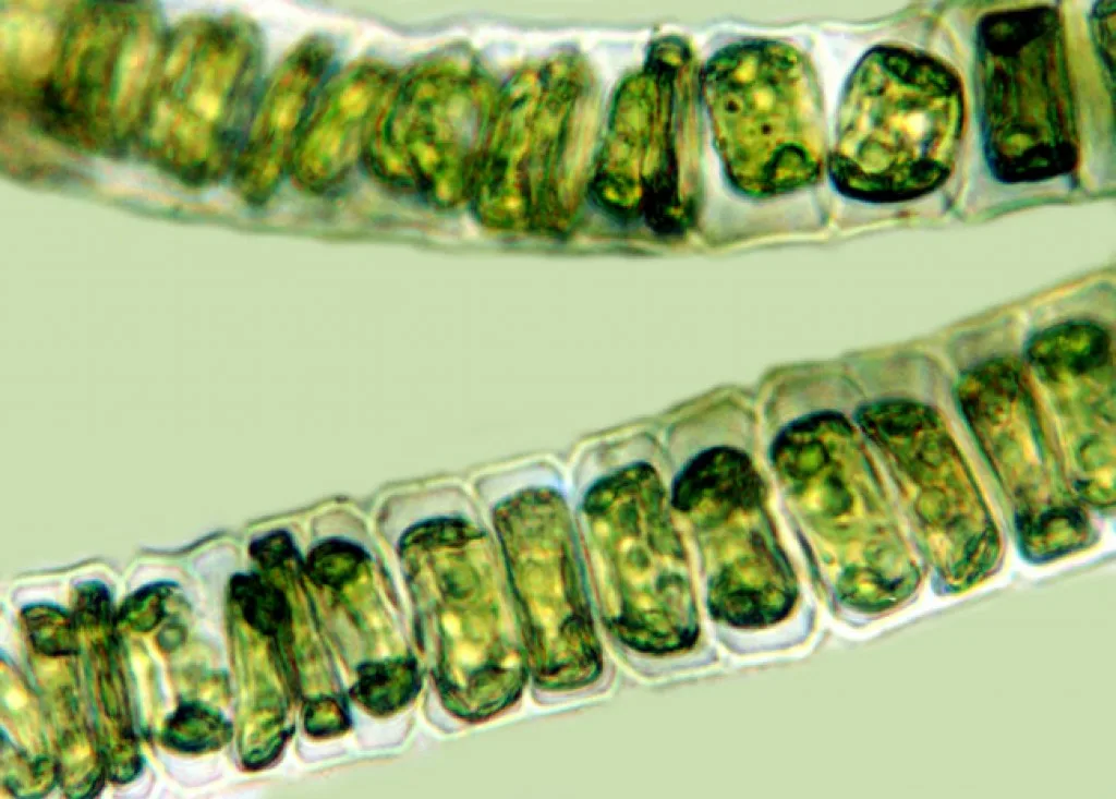 Улотрикс водоросль. Зеленые водоросли улотрикс. Нитчатый таллом улотрикса. Улотрикс опоясанный. Нитчатая водоросль улотрикс.