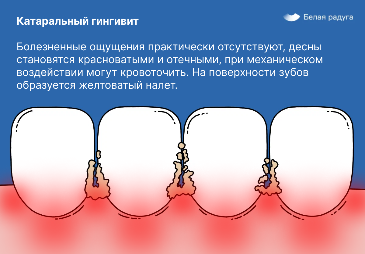 Почему у беременных болят десны | Белая радуга | Сеть стоматологических  клиник | Дзен