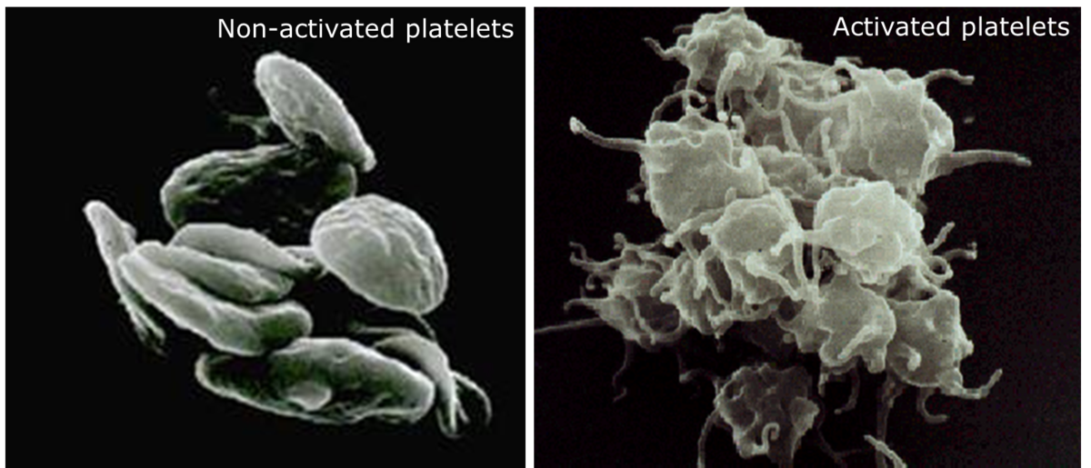 Non activated. Тромбоциты. Тромбоциты под микроскопом. Тромбоциты в микроскопе. Тромбоциты activated resting.