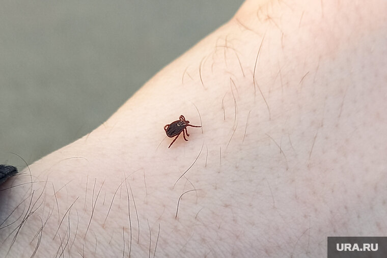    Евгения Хвалько укусил энцефалитный клещ в Краснотурьинске (архивное фото)