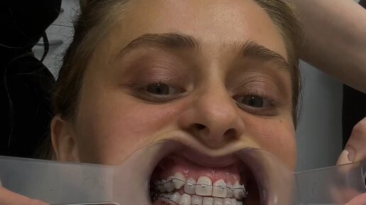 Александра Бальман | Ролик от 20.09.2023 продолжительностью 32 сек. | Дзен