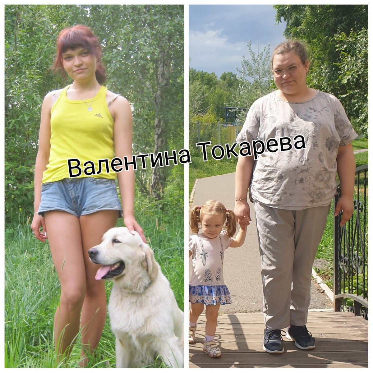 На первом фото далеко не минимальный вес, фото с периода анрексии, к сожалению не сохранилось, я тогда мечтала похудеть ещё "и вот тогда буду фотографироваться, этот момент так и не наступил, хотя минимальный вес был 47кг. На втором фото я 117кг, после второй беременности