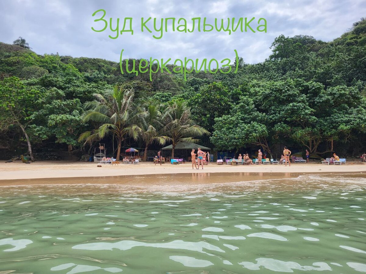 ✳️Церкариоз (зуд купальщика) - заболевание, связанное с аллергической реакцией на личинки (церкарии), которые проникают в кожу человека при купании в водоёмах, преимущественно, с пресной стоячей водой.
✳️Вызывается личинками плоских червей (жизненный цикл на фото в карусели👉🏻). Взрослые особо обитают в организме водоплавающих птиц или животных (бобры, ондатры). С их фекалиями в воду выделяются яйца, из которых вылупляются мирацидии. Мирацидии заражают определённый вид улиток, из которых впоследствии в воду выделяются церкарии. Далее церкарии проникают через кожу или проглатываются птицами/животными, развиваются в них вновь до взрослой особи и весь цикл повторяется заново. ❗️Важный момент: проникая в кожу человека, личинка погибает, поэтому от человека к человеку заболевание не передаётся❗️
✳️Заражение церкариями обычно происходит при купании в пресной, в основном, стоячей воде, где много водной растительности, и где мелко, именно поэтому дети попадают в группу риска, так как чаще проводят время на мелководье.
✳️Личинки, попадая в кожу человека, погибают, в ответ на их внедрение развивается аллергическая реакция. Проявляется это появлением на коже красных пятен и папул, которые вызывают сильный зуд. При массивной инвазии, может даже повыситься температура, появиться недомогание.
✳️Симптомы проходят самостоятельно в течение нескольких дней, иногда недель. На месте высыпаний иногда остаётся пигментация, которая также проходит сама через некоторое время.
✳️Диагноз ставится на основании жалоб, характерной клиники и анамнеза. Никаких подтверждающих лабораторных методов диагностики нет.
✳️Для облегчения симптомов (в первую очередь кожного зуда) могут применяться антигистаминные препараты 2-го поколения внутрь, наружно на область высыпаний лосьон, типа Каламина, в случае выраженного зуда, возможно применение местных гормональных препаратов коротким курсом.
✳️Профилактика: избегать купания на мелководье, где много растительности или стоячая вода; не прикармливать водоплавающих птиц или избегать купания в водоёмах, где они есть в большом количестве; после купания в водоёме, если есть возможность, сразу же принять гигиенический душ.

