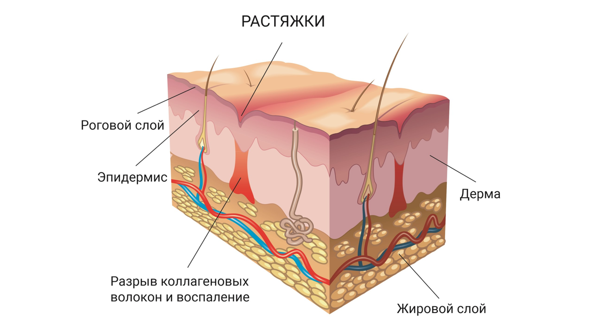 Как выглядит кожа внутри