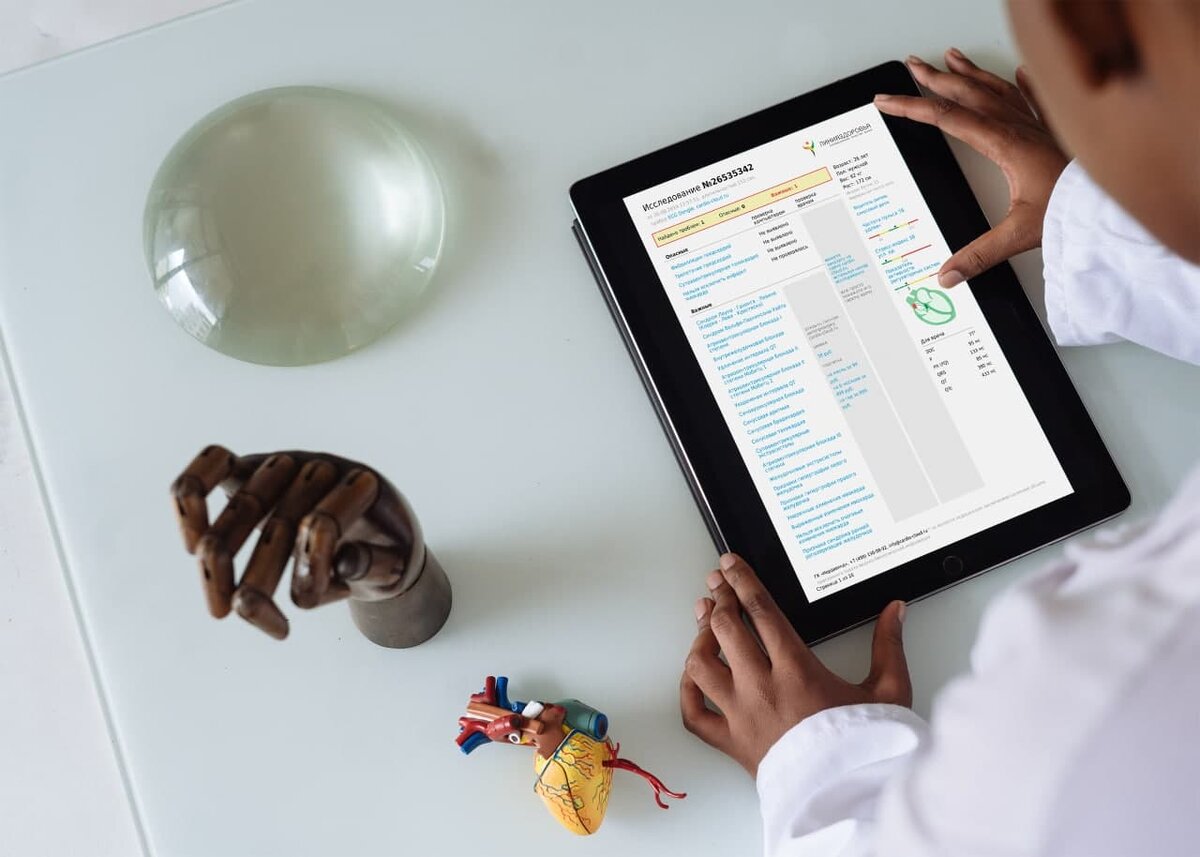 Так выглядит страница автоанализа ЭКГ на вашем мобильном устройстве