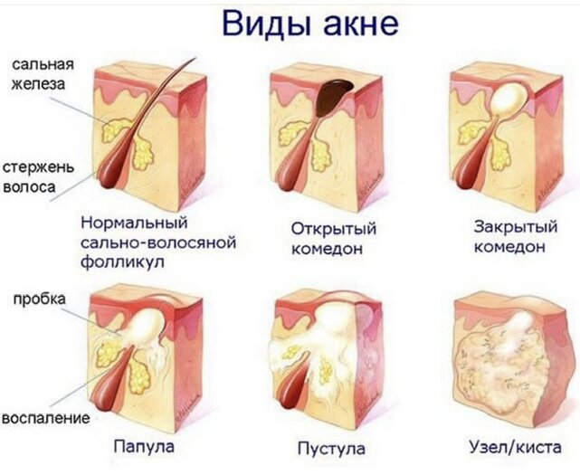 Изображение взято из открытых интернет-источников. 