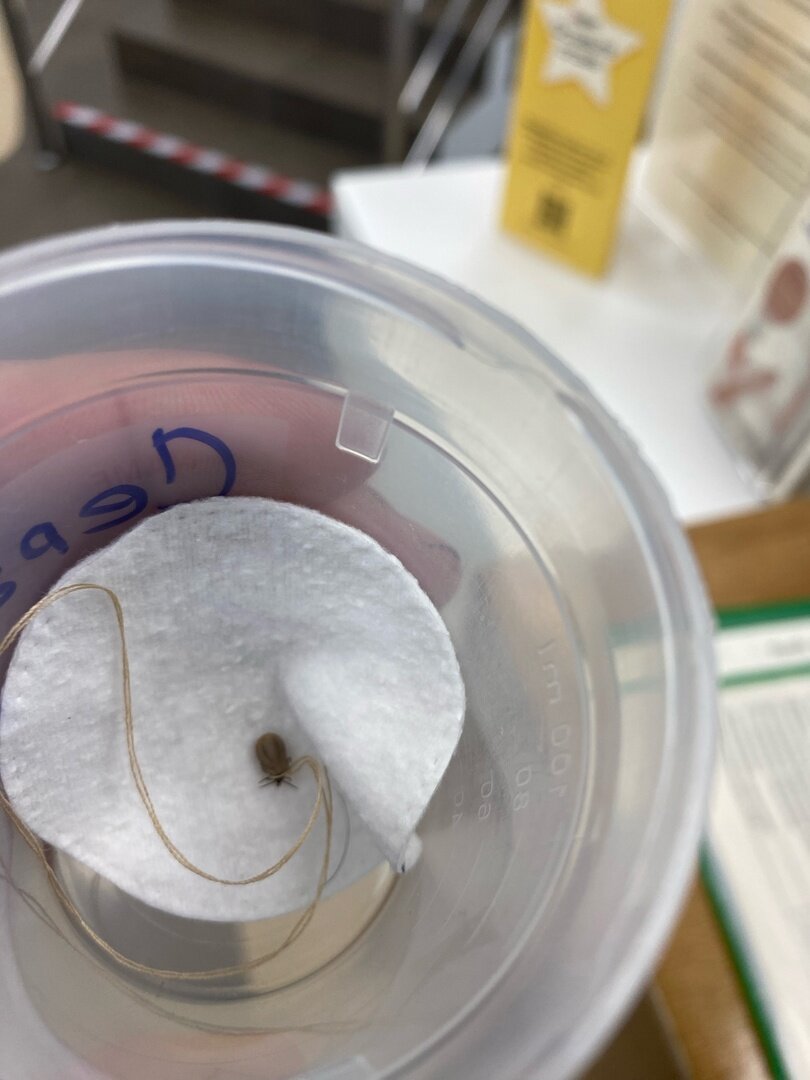 Клещ, напившись человеческой крови, устроился на белой салфетке и чувствовал себя прекрасно. Фото автора.