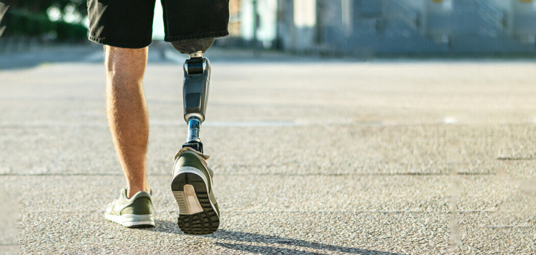 Те, кто лишился конечностей, отмечают, что ощу­ще­ния в ампутированной ру­ке вос­при­ни­мают­ся яр­че, чем в от­сут­ст­вую­щей но­ге Фото: © 22Images Studio / Shutterstock / FOTODOM