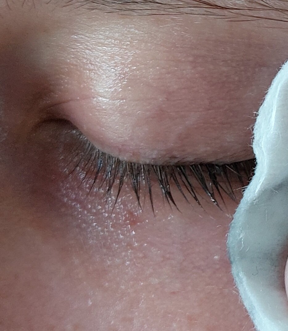 Средства для глаз рейтинг лучших