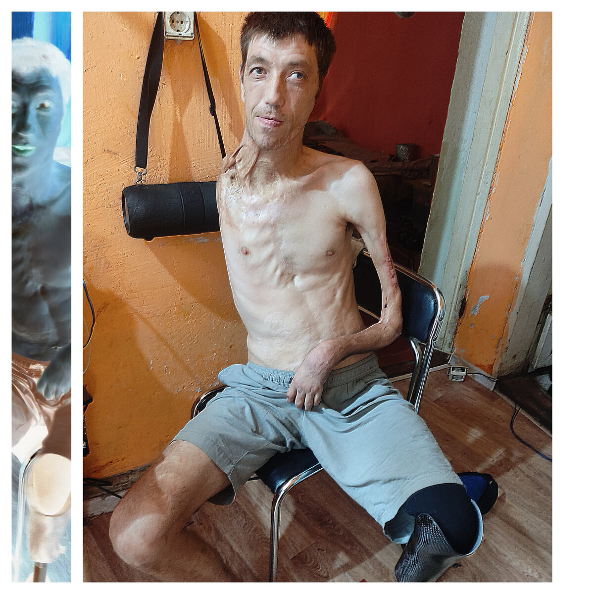 Человек-инвалид первой группы без рук без ног радуется в жизни живёт делится своими талантами с вами во всех соцсетях если не трудно поддержите хотя бы лайком