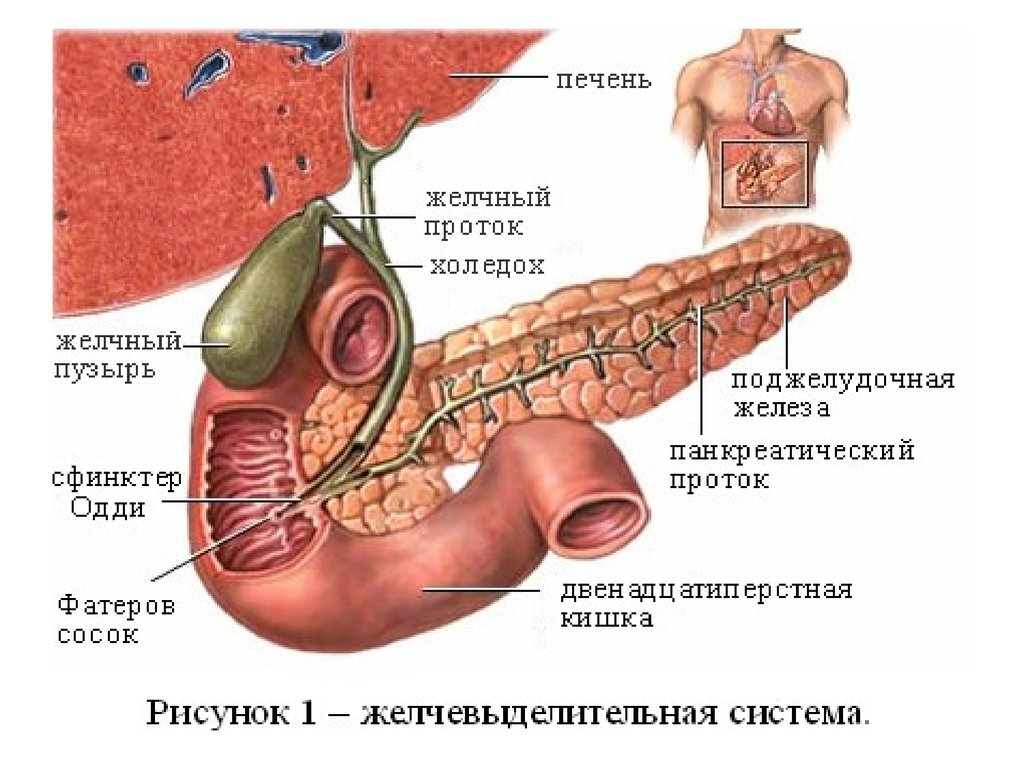 Желчнокаменная болезнь