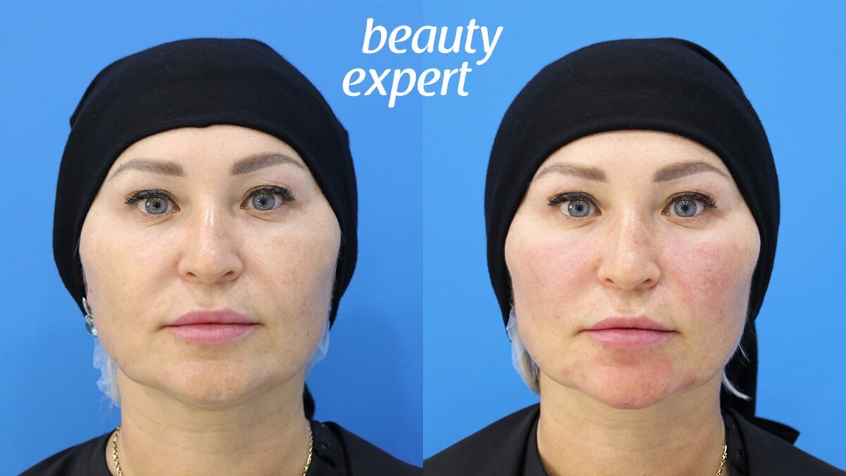 Результат (до-после)