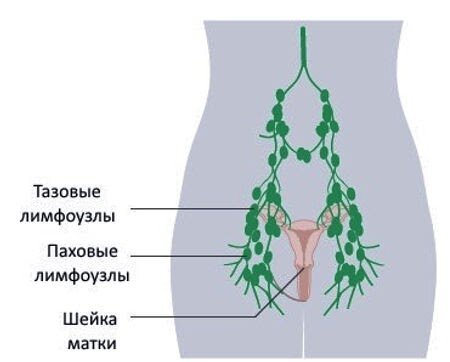 Лимфаденит — воспаление лимфоузлов