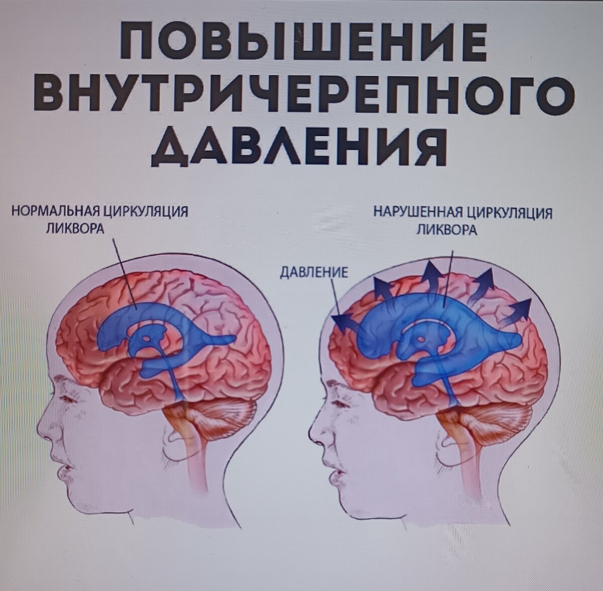 Как погода влияет на давление человека