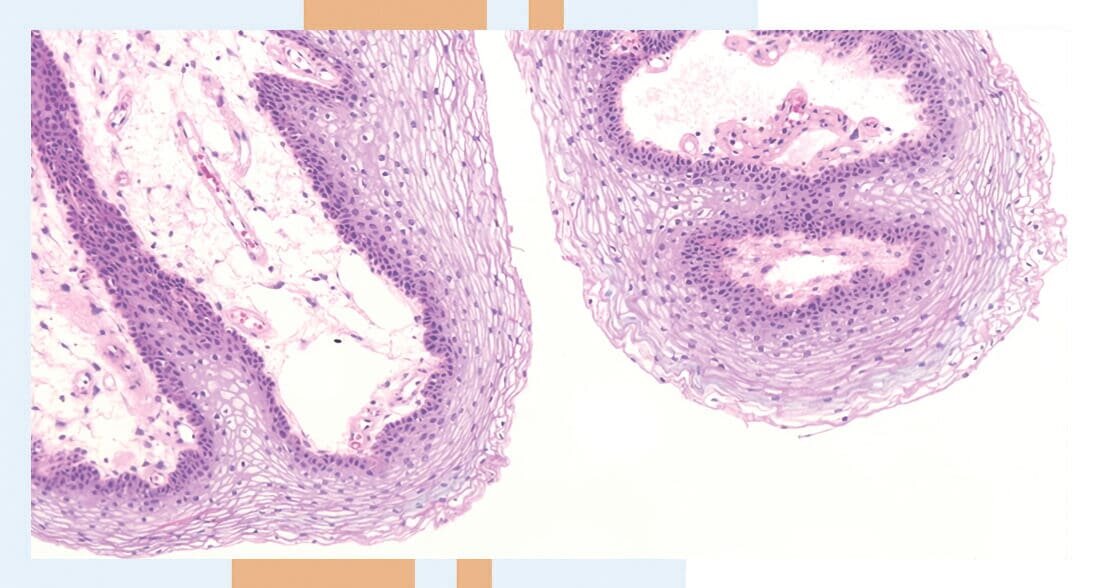 Полип желчного пузыря мкб 10. Код по мкб 10 болезни крови д. Мкб-10 международная классификация болезней 2020. Полип уретры код по мкб 10. Полип желчного пузыря код по мкб 10 код.