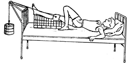 Вот  точно так он и лежал почти 1,5 месяца в больнице, только почему-то ещё и без трусов.