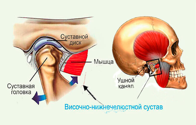 Артроз внчс классификация. Дисфункция височно-нижнечелюстного сустава. Височно челюстной сустав суставные поверхности. Артрит височно-нижнечелюстного сустава рентген протокол. Артрит височно-нижнечелюстного сустава.