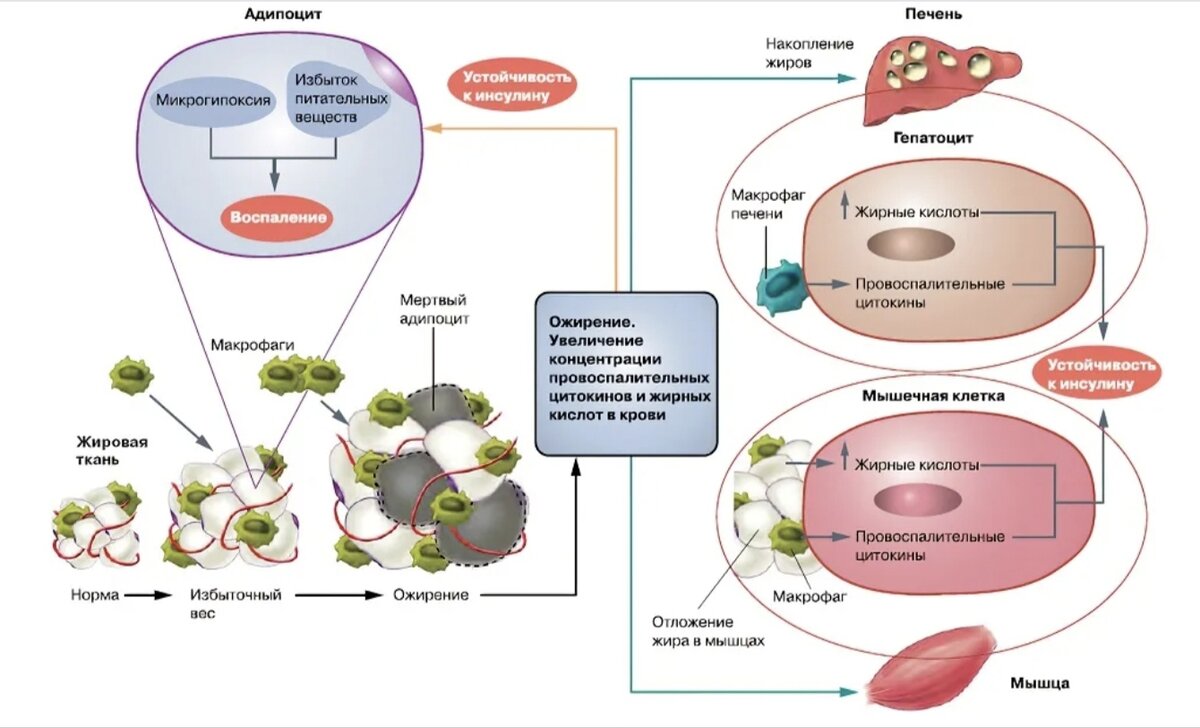 Процесс накопления жира. Ожирение при сахарном диабете 2 типа. Сахарный диабет схема. Этиология сахарного диабета 2 типа. Патогенез сахарного диабета 2 типа схема.
