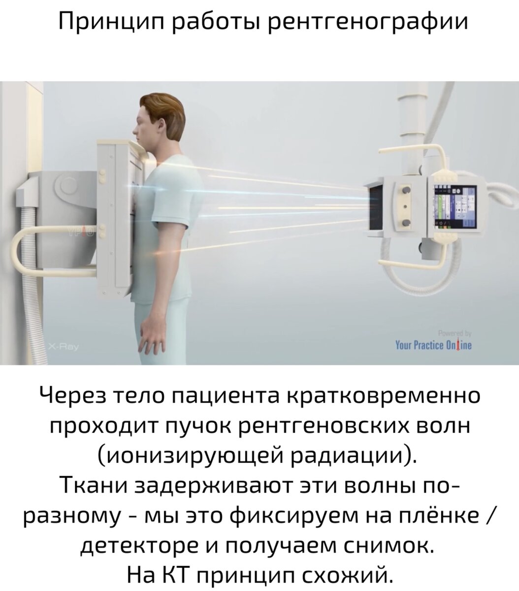 Доза имеет значение | Занимательная диагностика | Pro.Diagnosi | Дзен