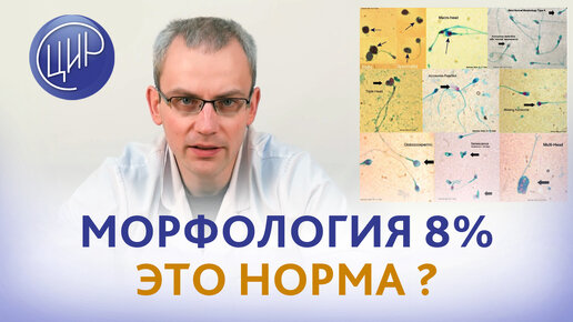 Морфология 8% это норма? Андролог ЦИР Живулько А.Р. Спермограмма и морфология сперматозоидов.