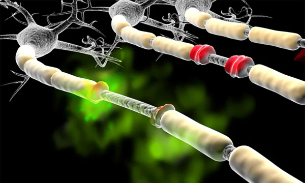 Визуализация процесса миелинизации нервных волокон