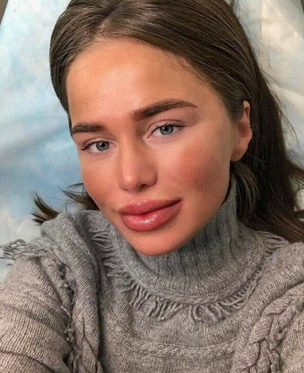 Алекса после операции