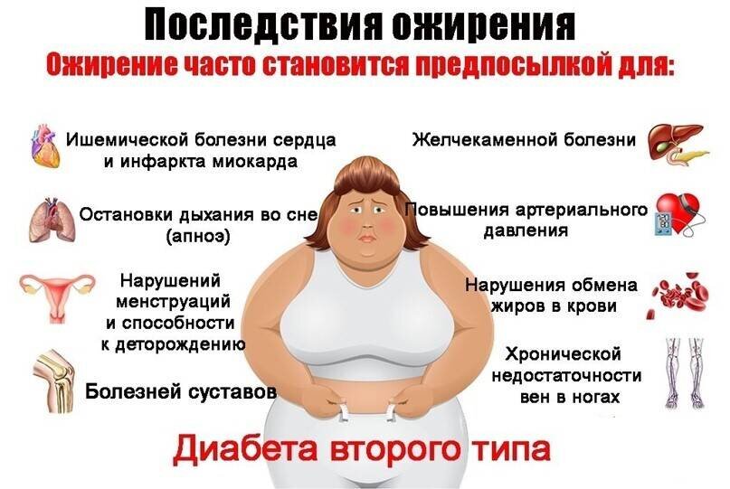 Ожирение: типы, степени, лечение
