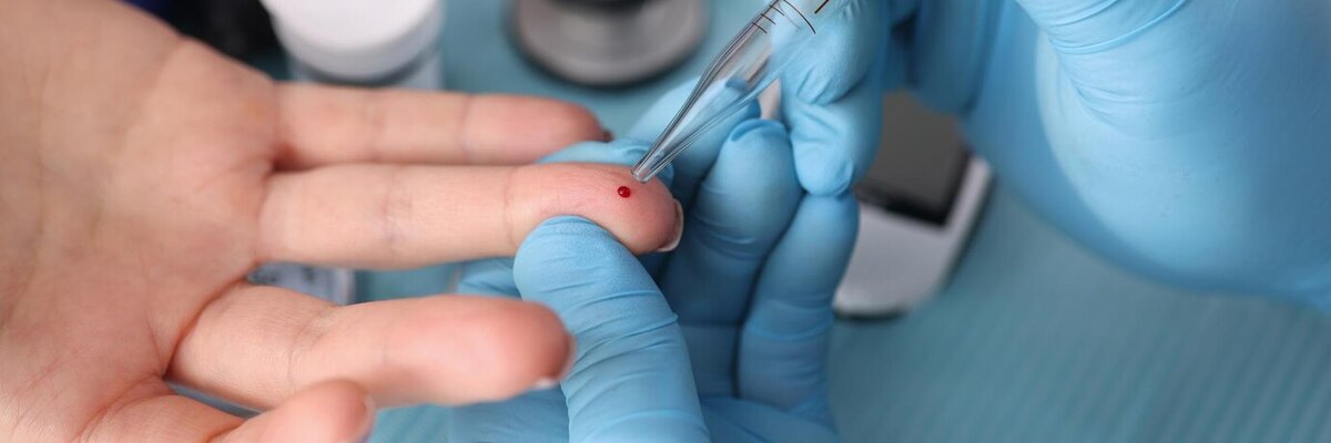 Фото с сайта https://ru.freepik.com/premium-photo/doctor-taking-blood-test-from-patient-finger-with-pipette-in-laboratory-closeup_25004767.htm