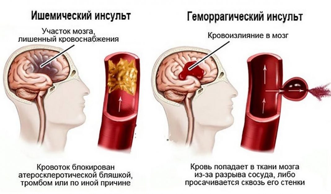 Может ли после замены