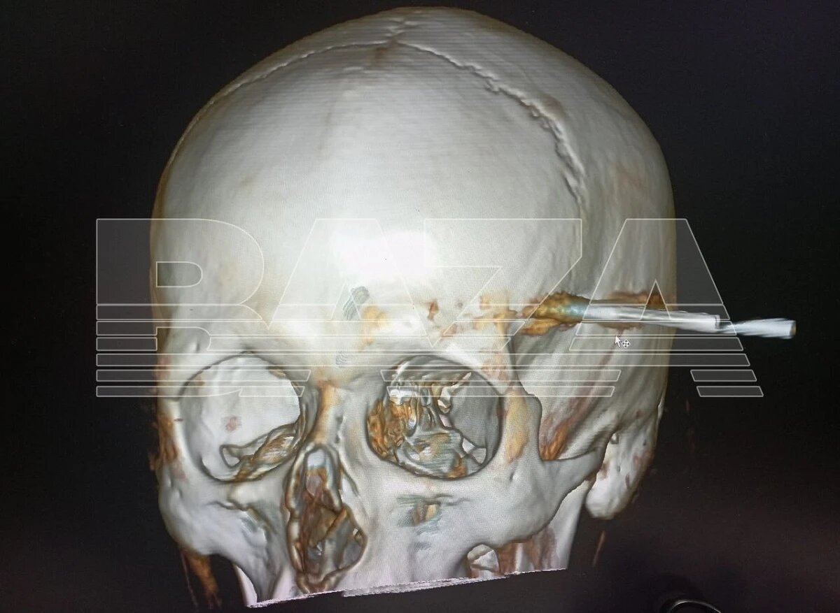 Фото: BAZA / Telegram