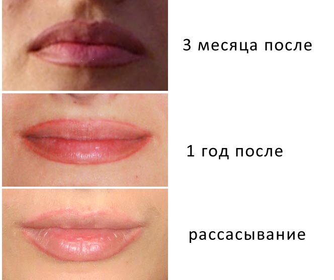 Татуаж контура губ | Отзывы | Цена тату губ в Киеве | А. Леонова