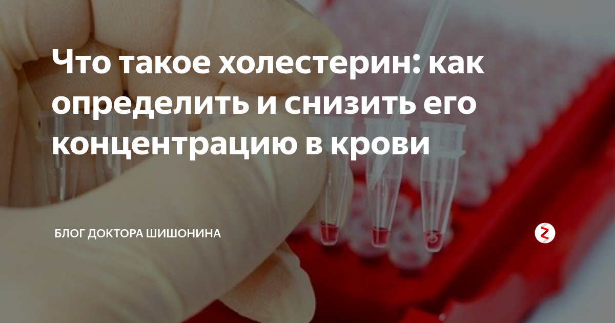 Шишонин атеросклероз. Шишонин атеросклероз