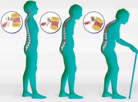 фото: http://cz-las.ru