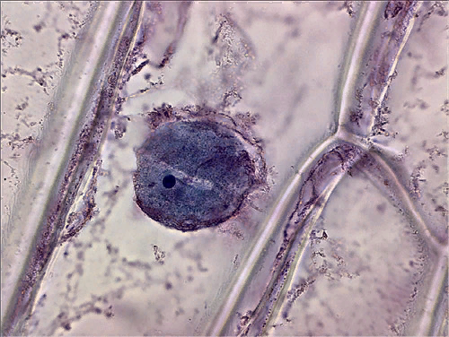 Ядро клетки под микроскопом.