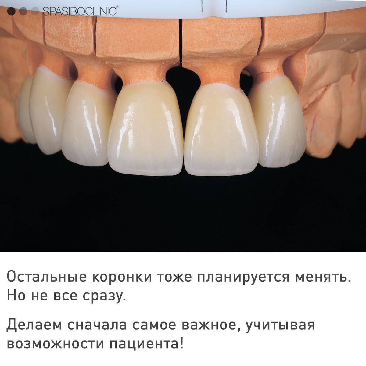 ПАРОДОНТИТ: ВОССТАНОВЛЕНИЕ | Спасибо.Клиник | Дзен