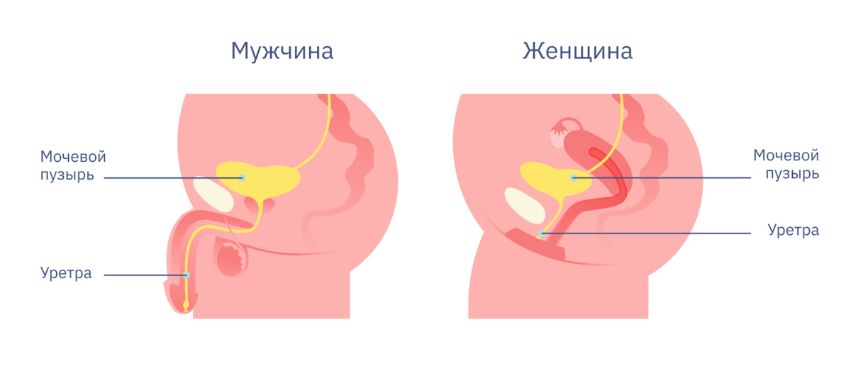 Мочевыводящие пути, воспаление