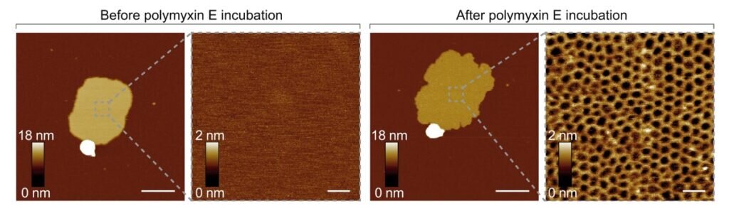    Клеточные мембраны под микроскопом: слева — до обработки колистином (полимиксином Е), справа — после / ©Selen Manioglu et al., 2022
