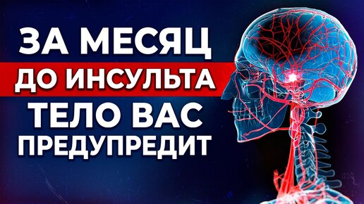 ОПАСНЫЕ предвестники инсульта! ПЕРВАЯ ПОМОЩЬ при инсульте