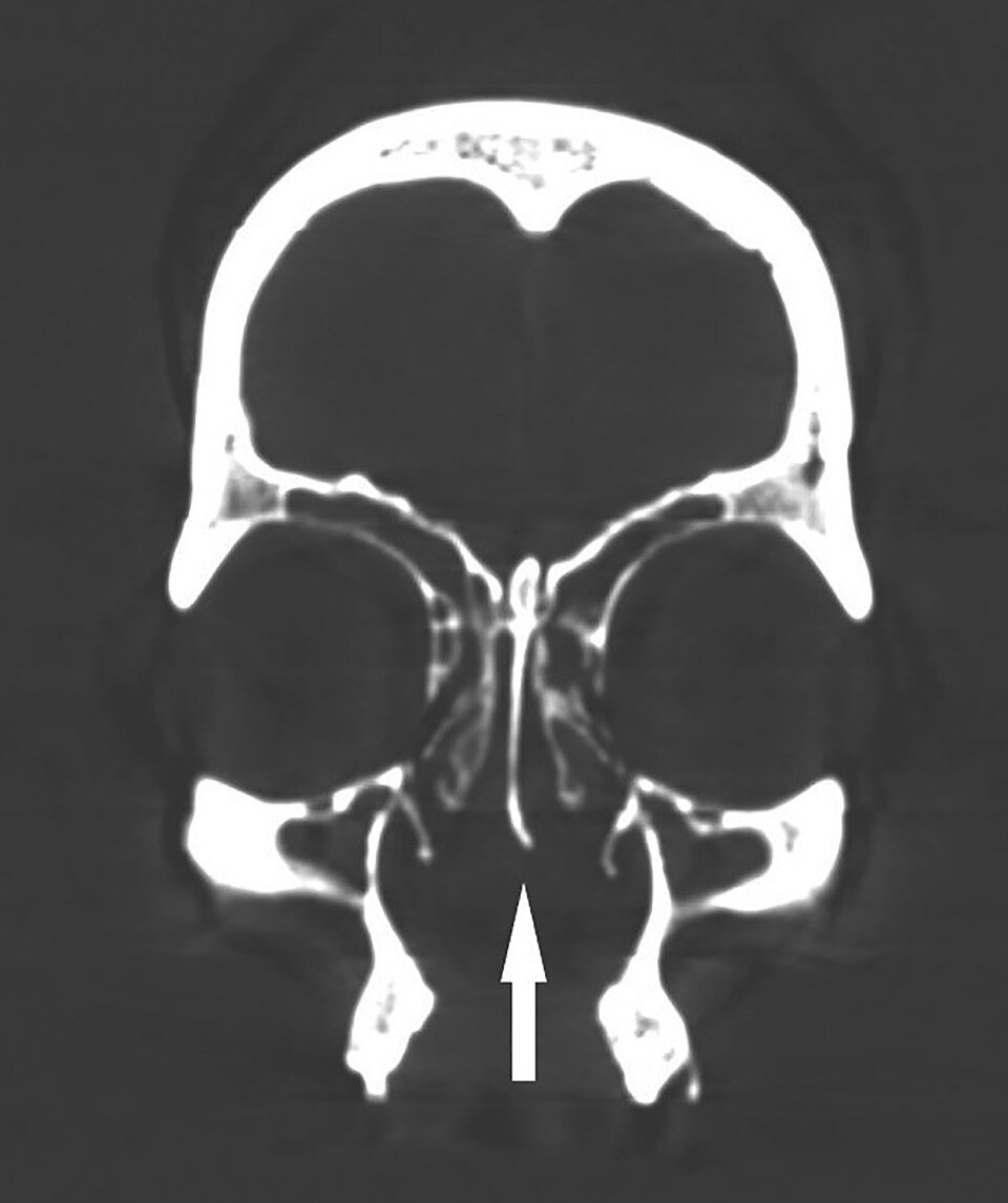   Anna Spinek et al. / Journal of Archaeological Science: Reports, 2023