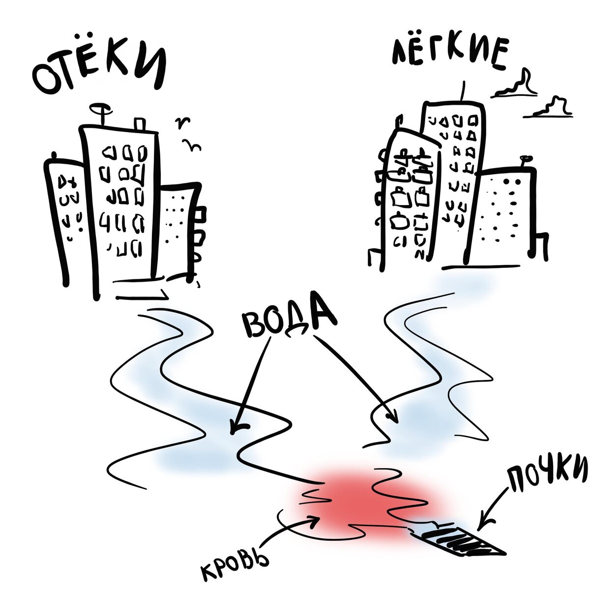 Почки как ливнёвка