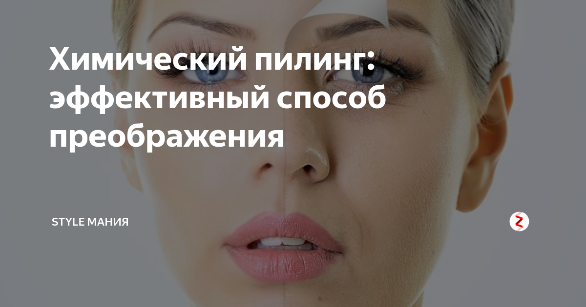 Химический пилинг: эффективный способ преображения | STYLE мания | Дзен